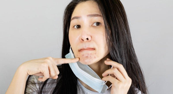 Maske Takmak Cilde Zarar Verir Mi?