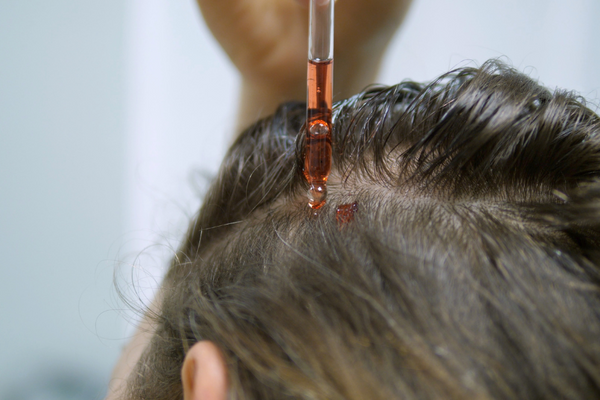 Vücutta Neden Sivilce Çıkar, Ne İyi Gelir?