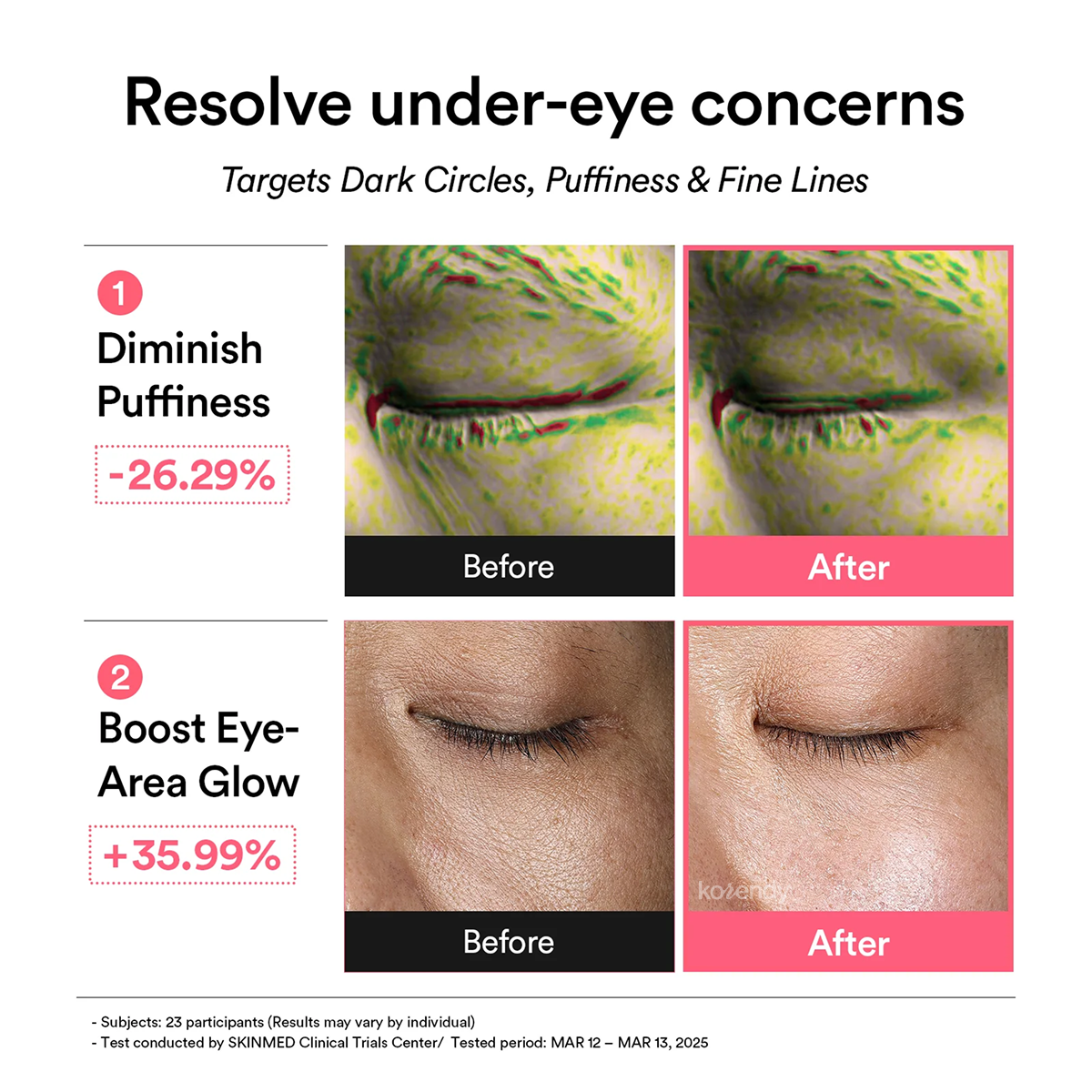 Abib - PDRN Retinal Eye Patch Glow Jelly (Parlatıcı Bitkisel PDRN, Retinal ve Kolajenli Hidrojel Göz Bandı) 84g (60ad) (%15-%30 Lansman İndirimi)