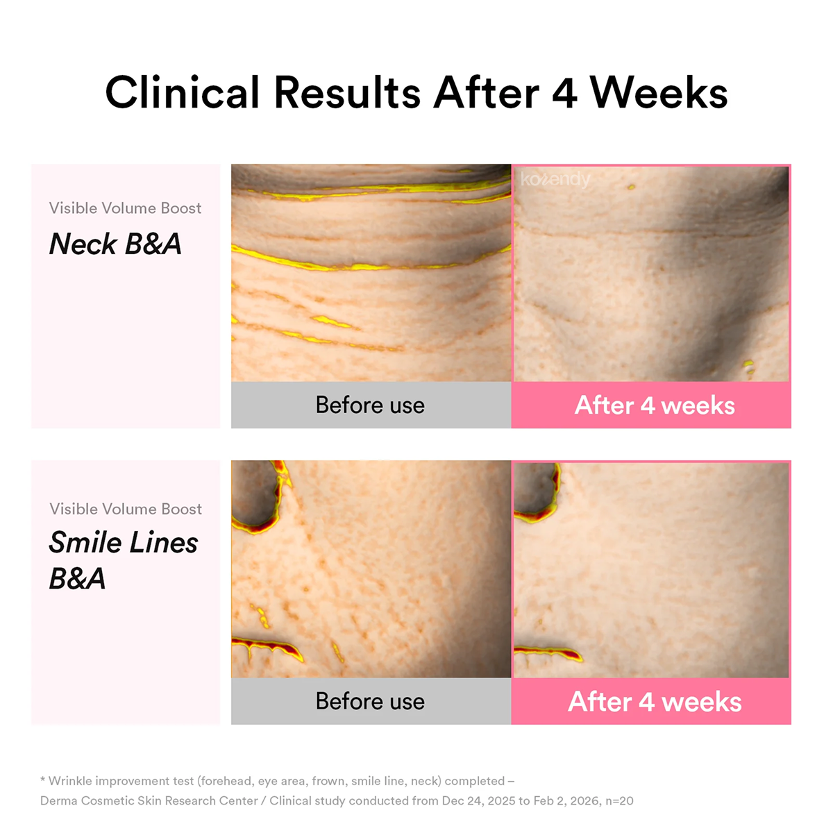 Abib - PDRN Volume Fill-It Booster 2.5 Tube (Sıkılık Koruyucu PDRN ve Volufiline İçeren Bakım Kremi) 30ml (%15-%30 Lansman İndirimi)