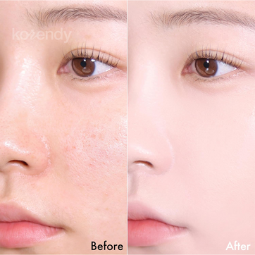 Amuse - Ceramic Skin Perfector SPF 40 PA++ (Seramid ve Peptitli Porselen Cilt Cushion) 15gr (%60 SKT İndirimli)