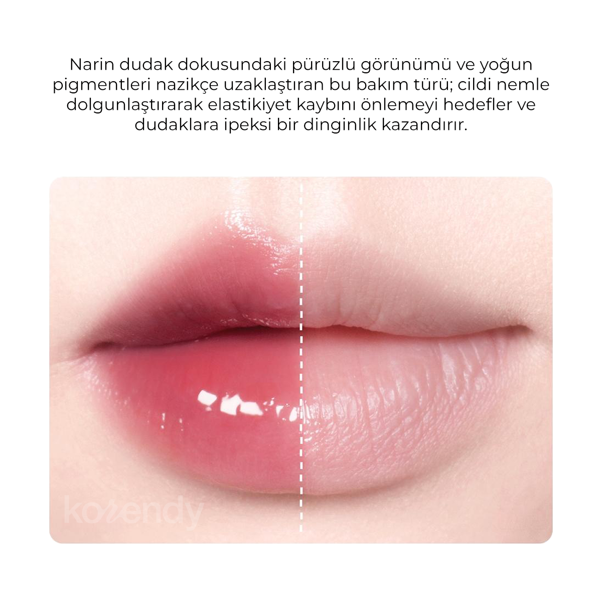 Amuse - Tint One Touch Remover (Tint ve Ruj Silen 6 Çeşit Peptitli Dudak Temizleyicisi) (%70 İndirimli)