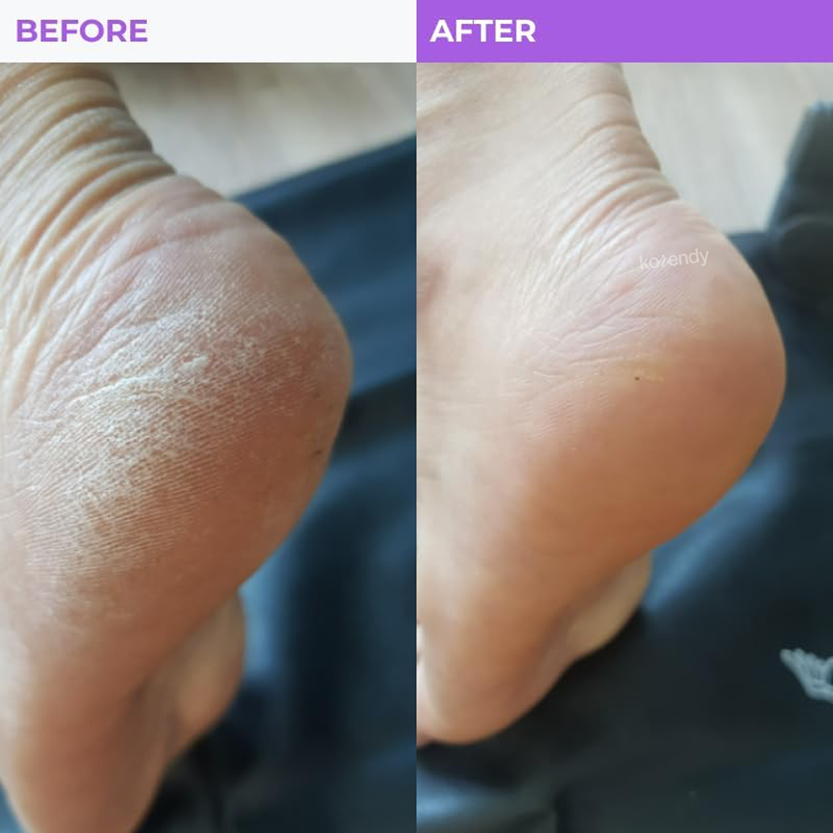 Baren - Callus Remover Double Sided Foot File (Çift Taraflı Pro Ayak Törpüsü) (%15-%30 Lansman İndirimi)