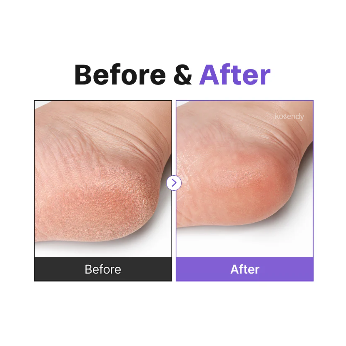 Baren - Centella Deep Soothing Ritual Foot Mask (Cica ve Üre İçeren SOS Hızlı Bakım Ayak Maskesi - Peeling Değildir) (%15-%30 Lansman İndirimi)