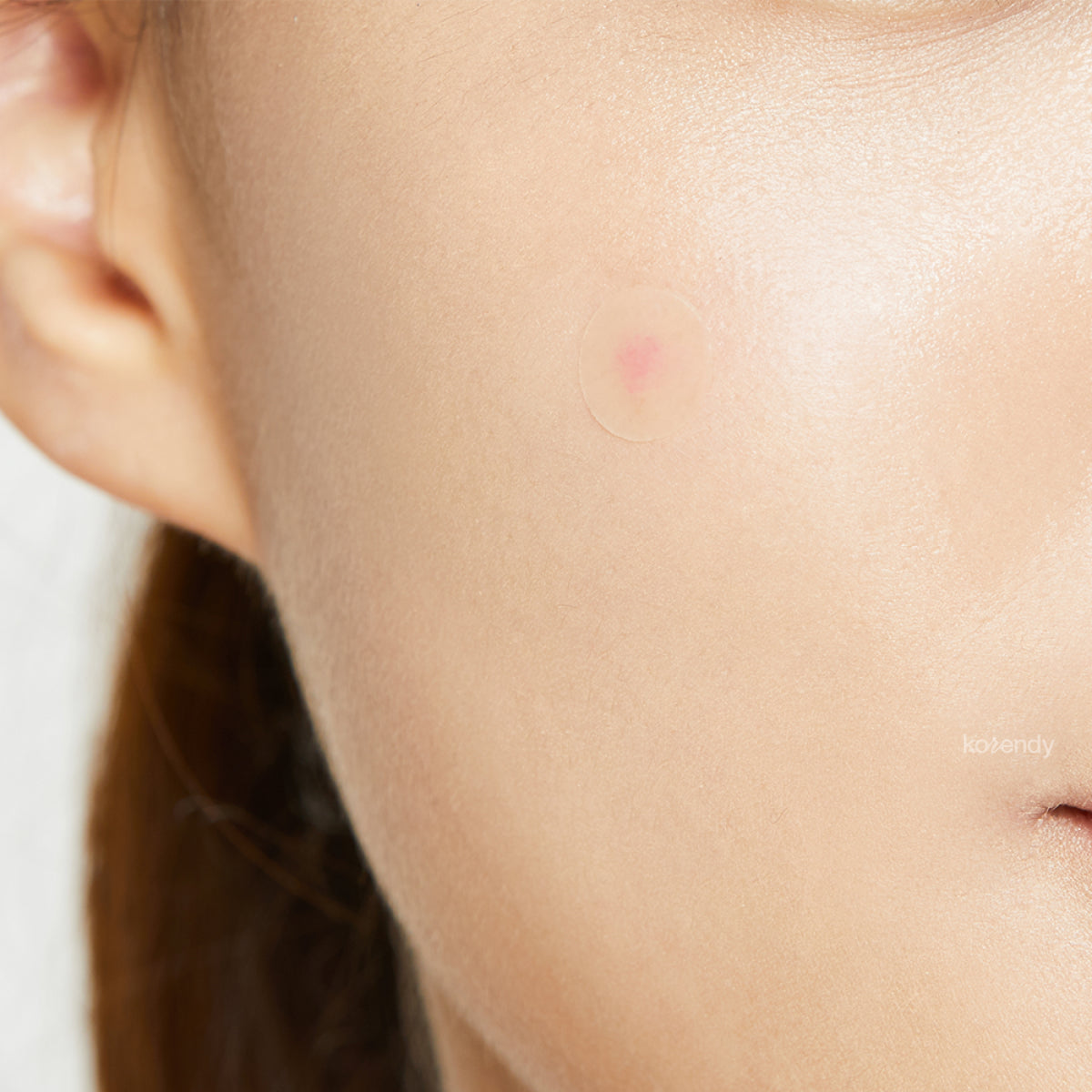 Cosrx - Acne Pimple Master Patch (Akne ve Sivilce Söndürücü Şeffaf Bant) 24'lü (%25 indirimli)
