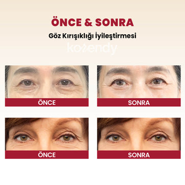 K-Secret - SEOUL 1988 Eye Cream Retinal Liposome 4% + Fermented Bean (İnce Çizgi Önleyici ve Elastikiyet Koruyucu 3 Peptitli ve Retinalli Göz Kremi) 30ml
