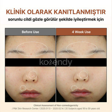 By Wishtrend - Mandelic Acid Gentle Exfoliating Toner (Pürüz ve Geniş Gözenek Önleyici Ölü Deri Arındırıcı Mandelik Asitli Peeling Toniği)