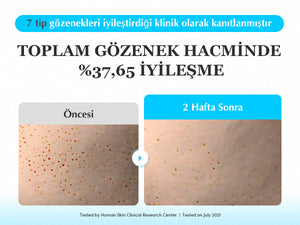 EqqualBerry - Swimming Pool Ampoule (Yoğun Hidrasyon Verici ve Geniş Gözenek Önleyici 8 Hyaluronik Asitli Ampul) 50ml