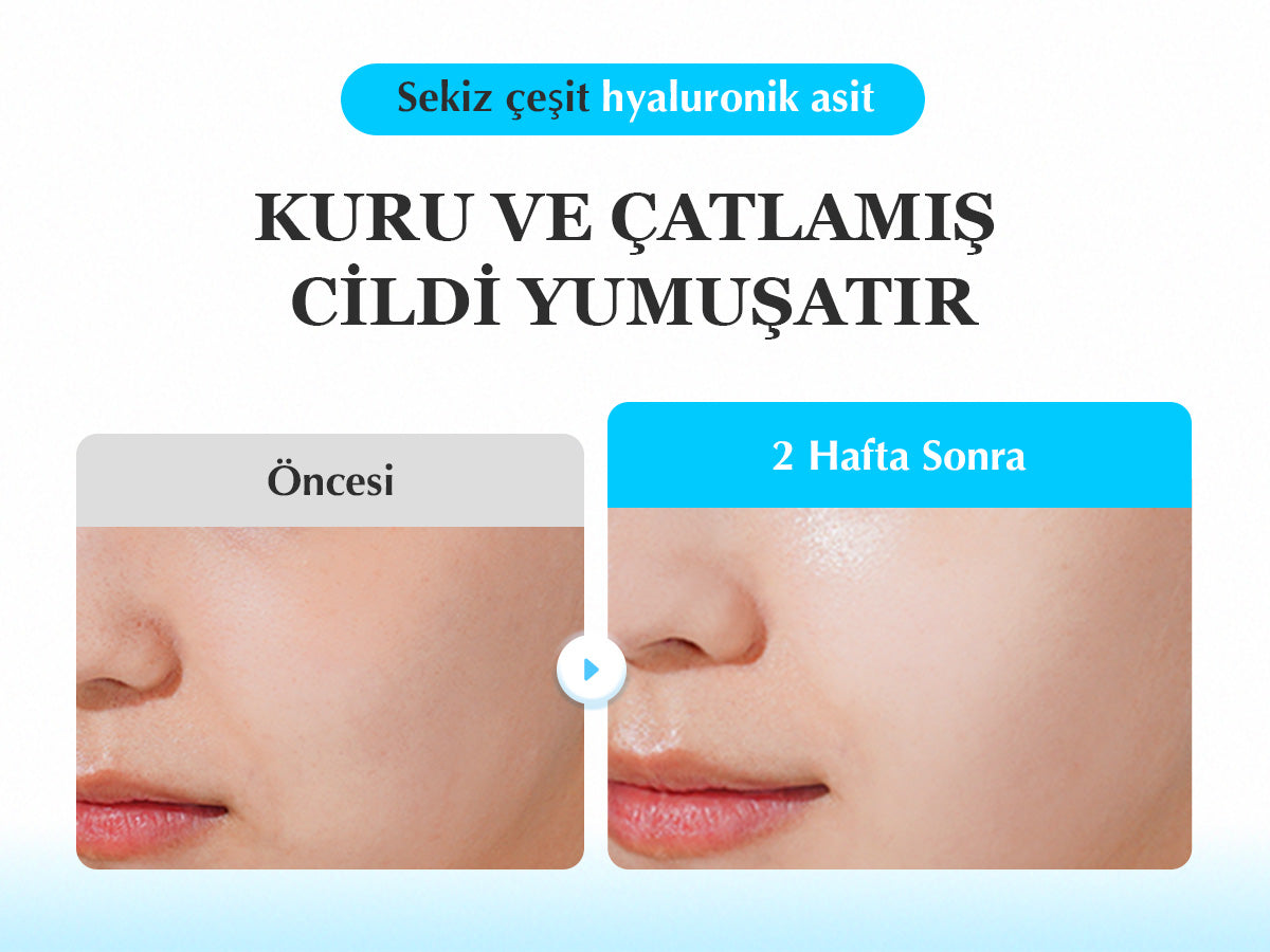 EqqualBerry - Swimming Pool Ampoule (Yoğun Hidrasyon Verici ve Geniş Gözenek Önleyici 8 Hyaluronik Asitli Ampul) 50ml