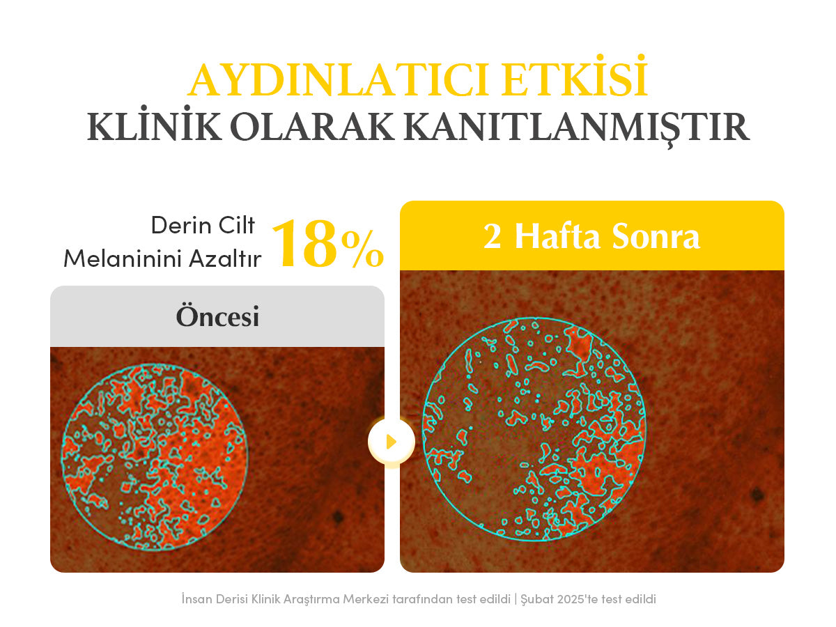 EqqualBerry - Collagen Glow up Hydrogel Mask (4'lü) (Leke Önleyici ve Parlatıcı Kolajenli ve Glutatyonlu Şeffaflaşan Maske)