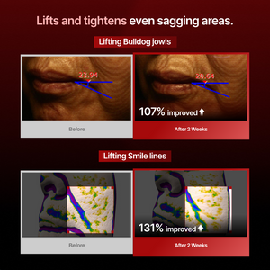 lifts and tightens even sagging areas