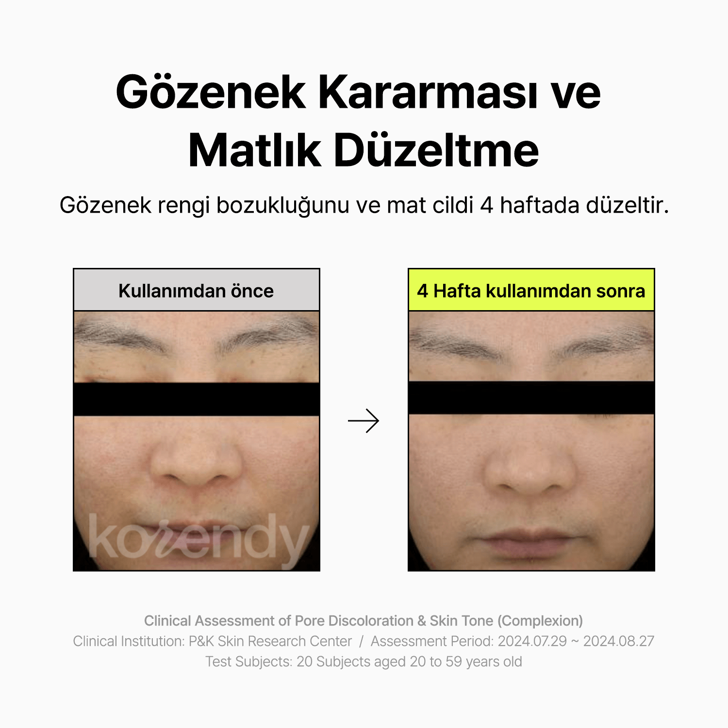 By Wishtrend - Pore Smoothing Bakuchiol Serum (Geniş Gözenek Karşıtı Elastikiyet Koruyucu Bakuchiol Serumu) (%20 İndirimli)