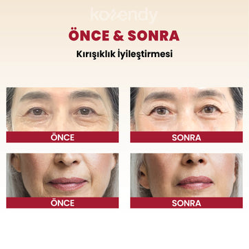 K-Secret - SEOUL 1988 Cream Retinal Liposome 1% + Fermented Rice (Kırışıklık & Leke Önleyici Pürüz Engelleyici %1 Retinalli Pirinç Fermentli Krem) 50ml