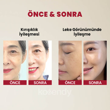 K-Secret - SEOUL 1988 Serum Retinal Liposome 2% + Black Ginseng (İnce Çizgi & Leke Karşıtı Pürüz Önleyici %2 Retinal Lipozom + Siyah Ginsengli Serum) 30ml