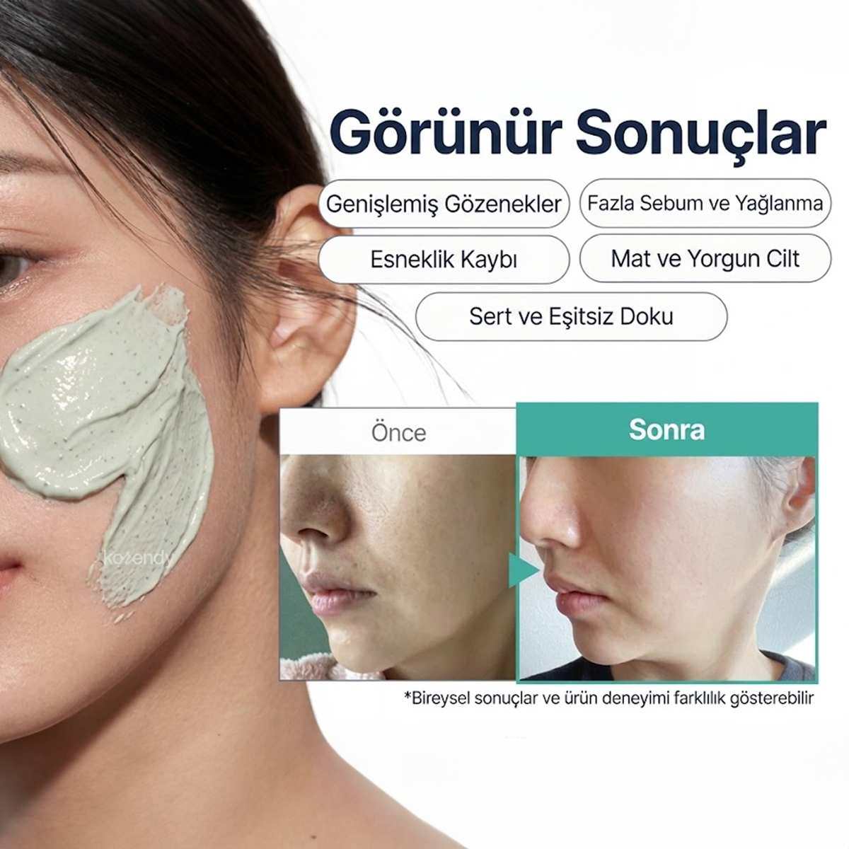 Torhop - Loyly Green-mud Collagen Mask (Gözenek Arındırıcı ve Elastikiyet Koruyucu Vegan Kolajenli Krem Kil Maskesi) (%15-%30 Lansman İndirimi)