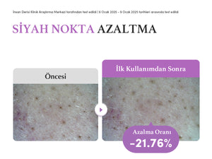 EqqualBerry - Purple Rice Pore Smoothing Cleansing Oil (Siyah Nokta Önleyici Gözenek Arındırıcı Mor Pirinçli Temizleyici Yağ) 200ml