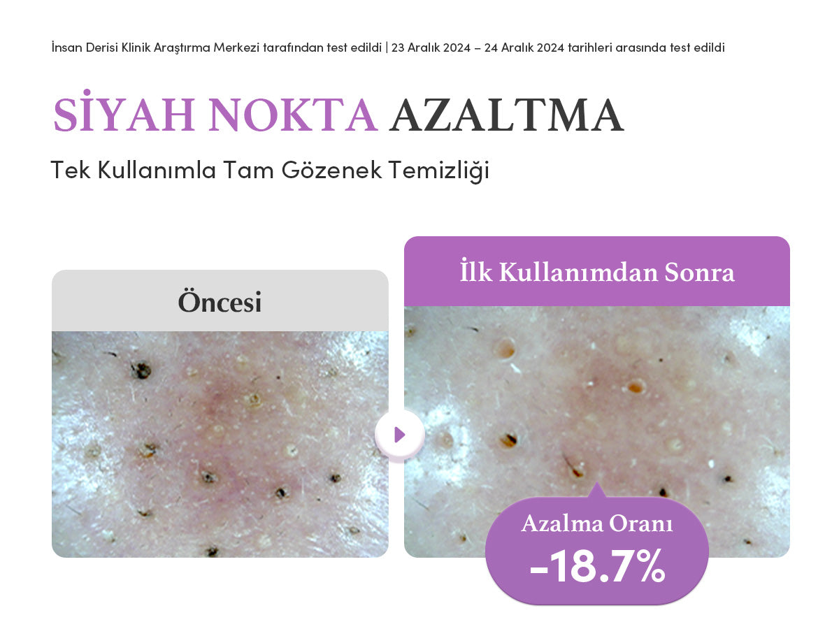 EqqualBerry - Purple Rice Pore Purifying Pack Cleanser (Geniş Gözenek Önleyici ve Ölü Deri Arındırıcı Mor Pirinçli Temizleyici) 130gr