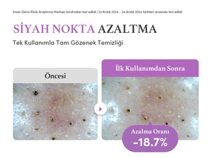 EqqualBerry - Purple Rice Pore Purifying Pack Cleanser (Geniş Gözenek Önleyici ve Ölü Deri Arındırıcı Mor Pirinçli Temizleyici) 130gr