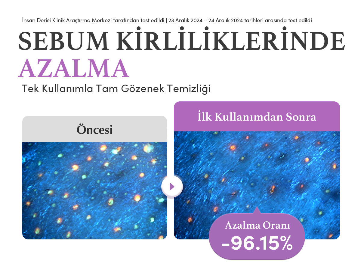 EqqualBerry - Purple Rice Pore Purifying Pack Cleanser (Geniş Gözenek Önleyici ve Ölü Deri Arındırıcı Mor Pirinçli Temizleyici) 130gr