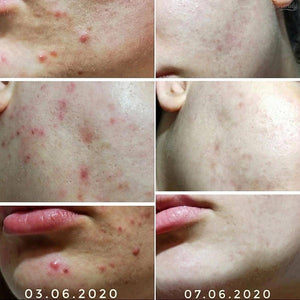 By Wishtrend - Sulfur 3% Clean Gel 30gr Jel Cilt Bakım 