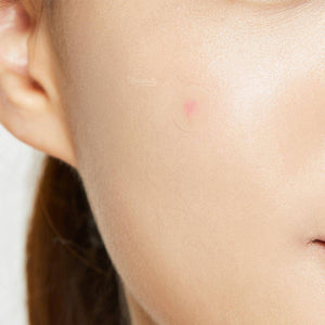 Cosrx - Acne Pimple Master Patch - 24 Parça Arac Korendy Türkiye Turkey Kore Kozmetik Kbeauty Cilt Bakım 