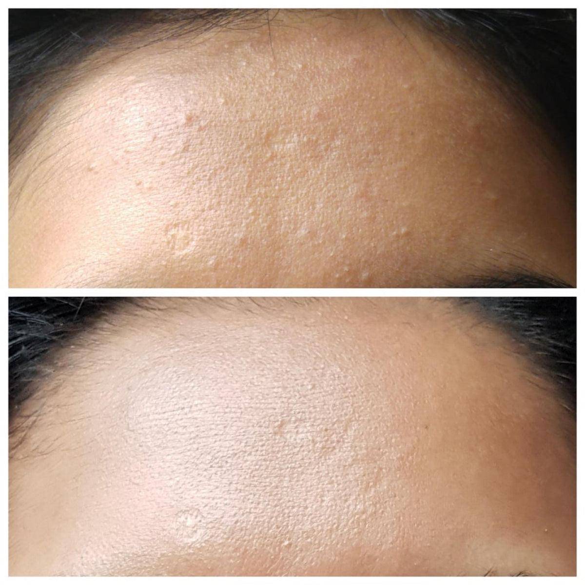 Cosrx AHA Whitehead Power Liquid ml Kimyasal Peeling