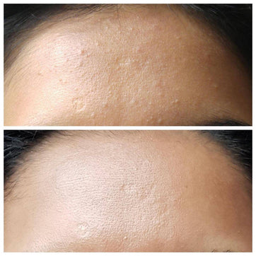 Cosrx AHA Whitehead Power Liquid ml Kimyasal Peeling