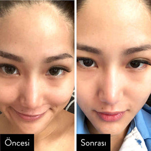 I'm From - Rice Toner 30ml/150ml Tonik Korendy Türkiye Turkey Kore Kozmetik Kbeauty Cilt Bakım 
