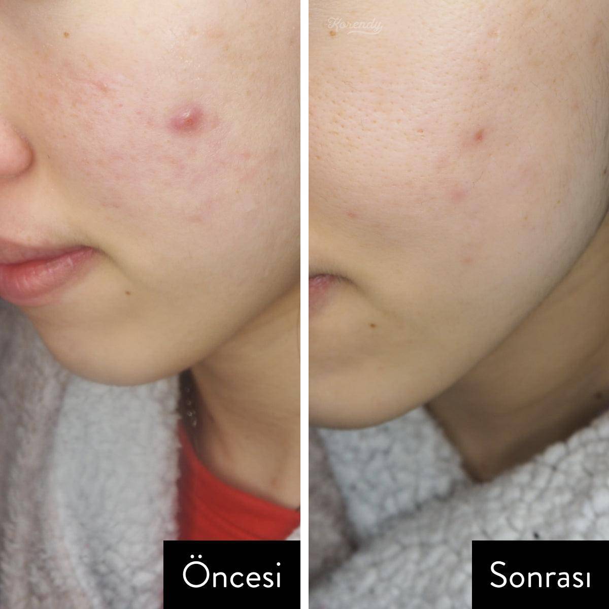 Jumiso - All Day Vitamin Brightening & Balancing Facial Serum 5ml/30ml Serum Korendy Türkiye Turkey Kore Kozmetik Kbeauty Cilt Bakım 