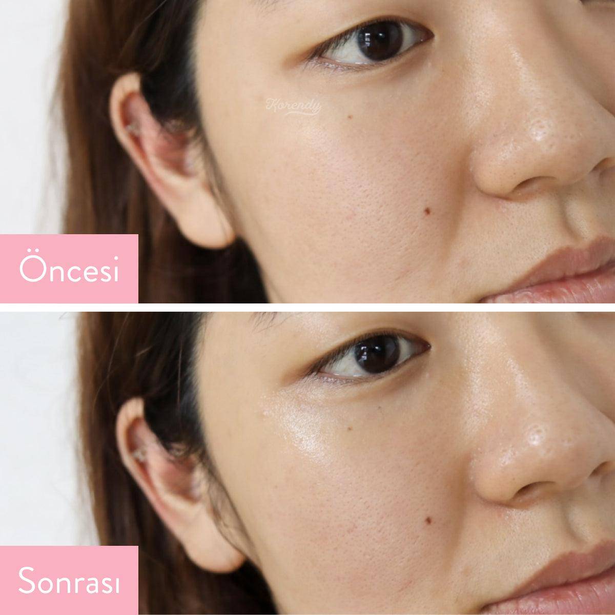 Jumiso - Yes I am Toner AHA 5% 150ml (Kimyasal Peeling) Peeling Korendy Türkiye Turkey Kore Kozmetik Kbeauty Cilt Bakım 