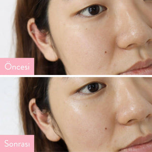Jumiso - Yes I am Toner AHA 5% 150ml (Kimyasal Peeling) Peeling Korendy Türkiye Turkey Kore Kozmetik Kbeauty Cilt Bakım 