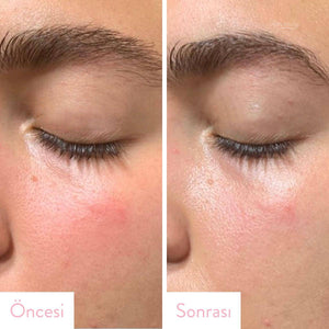 Klairs - Rich Moist Soothing Serum 80ml Jel Korendy Türkiye Turkey Kore Kozmetik Kbeauty Cilt Bakım 
