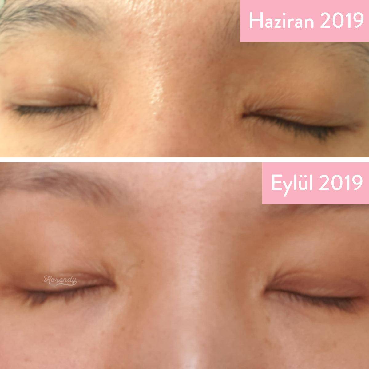 Manyo - Bifidalacto Ampoule Eye Cream 30ml Krem (Göz) Korendy Türkiye Turkey Kore Kozmetik Kbeauty Cilt Bakım 