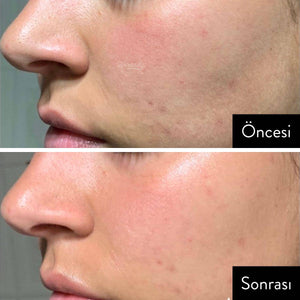 Pyunkang Yul - Balancing Gel 60ml Jel Korendy Türkiye Turkey Kore Kozmetik Kbeauty Cilt Bakım 