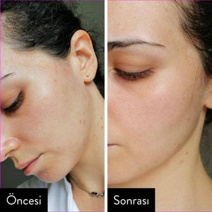 Rovectin - Cica Care Purifying Toner 260ml Tonik Korendy Türkiye Turkey Kore Kozmetik Kbeauty Cilt Bakım 