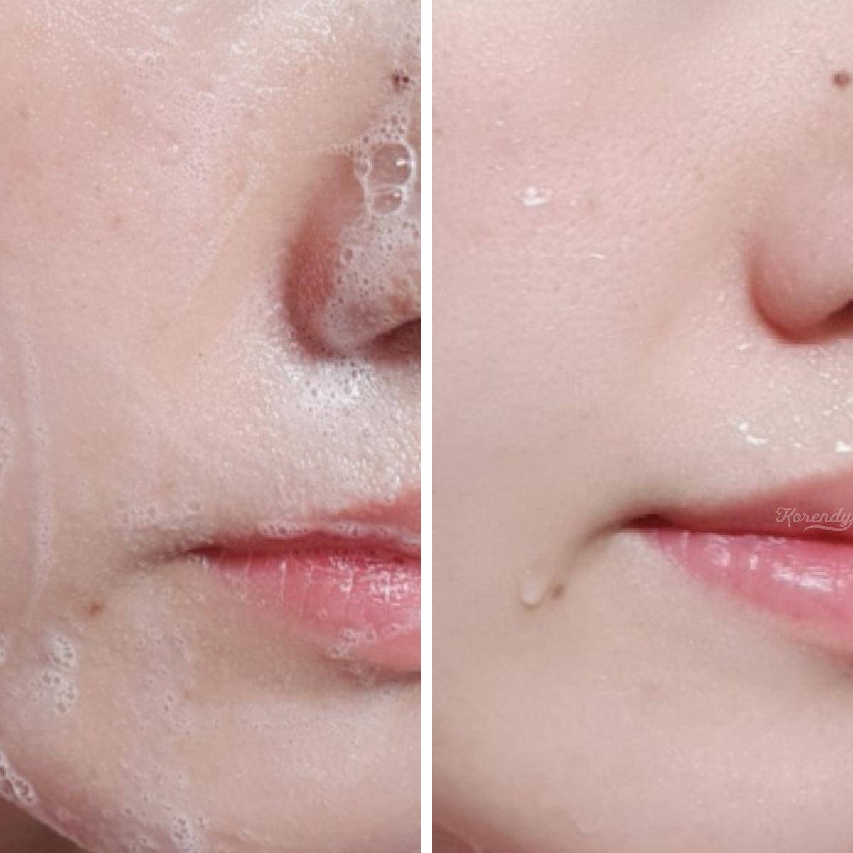 Rovectin - Conditioning Cleanser 20ml/175ml Temizleyici (Su Bazlı) Korendy Türkiye Turkey Kore Kozmetik Kbeauty Cilt Bakım 