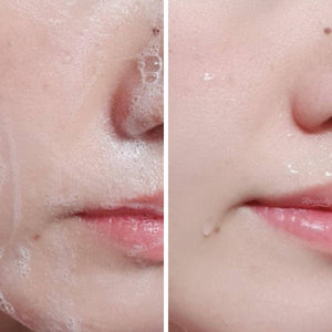 Rovectin - Conditioning Cleanser 20ml/175ml Temizleyici (Su Bazlı) Korendy Türkiye Turkey Kore Kozmetik Kbeauty Cilt Bakım 